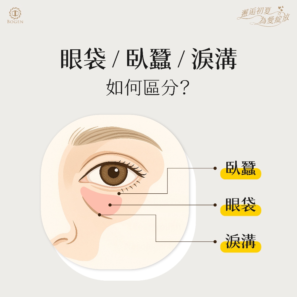 眼袋臥蠶與淚溝的區分,博恩妍